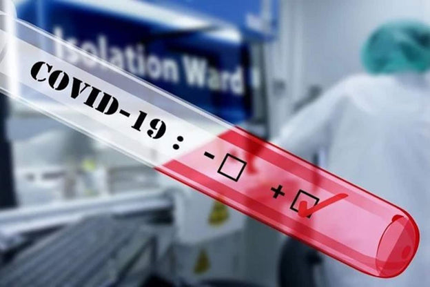 What should you do once you test positive for Corona virus?